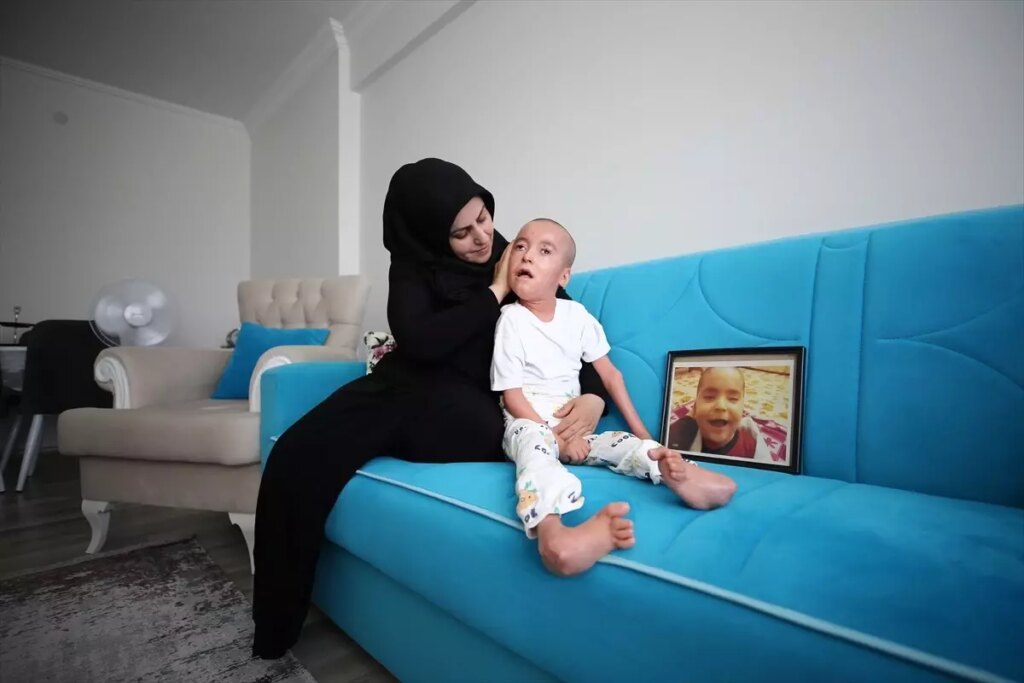 Anne Nihal, İktiyozis Hastası Oğluna Hayatını Adamış