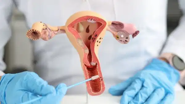 uzmanindan kritik uyari rahim agzi kanseri ilerlemeden belirti vermez yTvasDgh.jpg